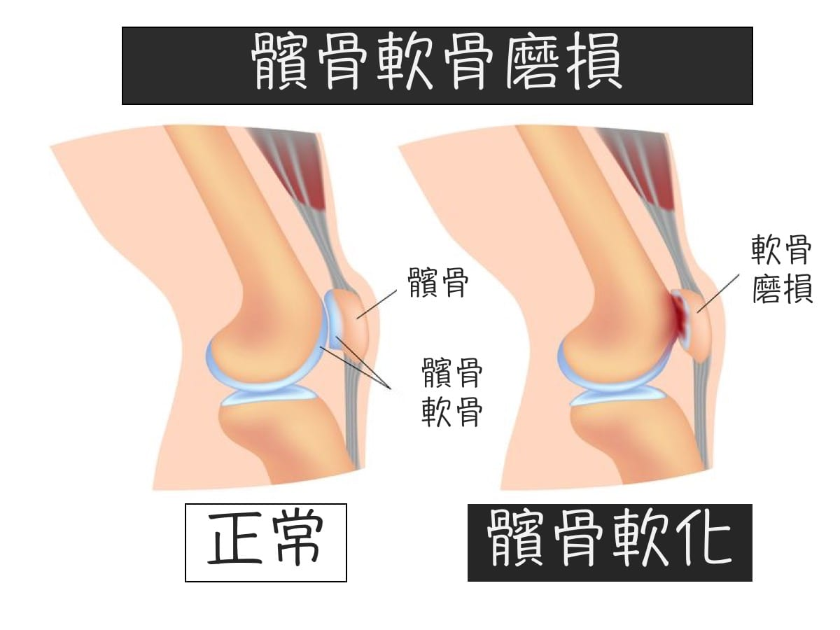 https://drbao.org/runner-knee-tx/